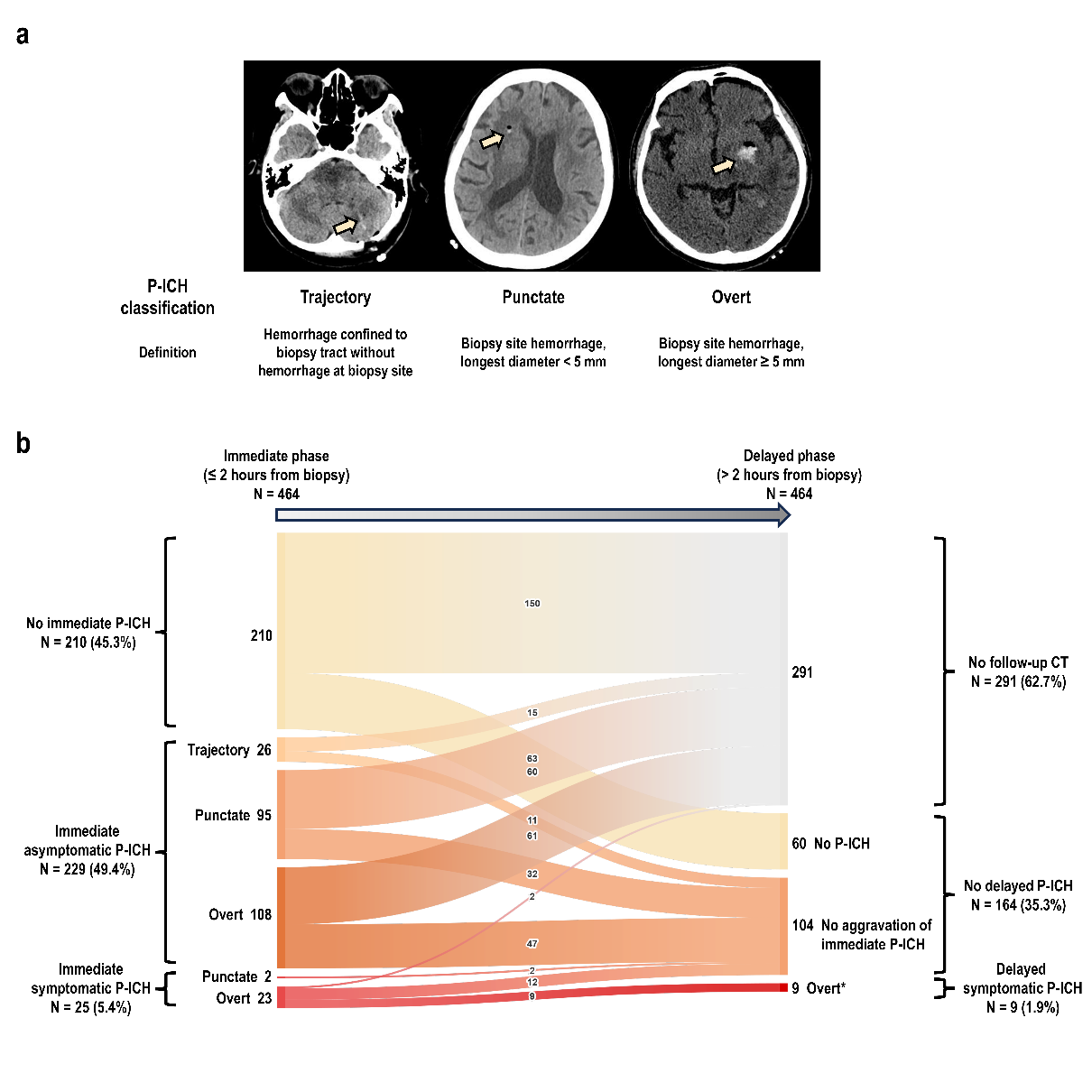 Prediction of postoperative intracerebral hemorrhage following brain biopsy